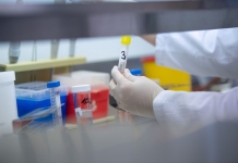 MEC alocă 25 de milioane de lei pentru proiecte de cercetare privind limitarea extinderii şi combaterea epidemiei de SARS-COV-2